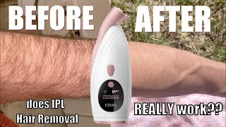 WARNING Do NOT Try IPL Hair Removal Without Watching This [upl. by Hollander967]