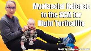 Gentle Sternocleidomastoid Myofascial Release RightSided Torticollis Treatment in Babies 042R [upl. by Joye565]