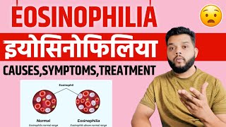 Eosinophilia Causes Symptoms amp Treatment In Hindi [upl. by Ardme]