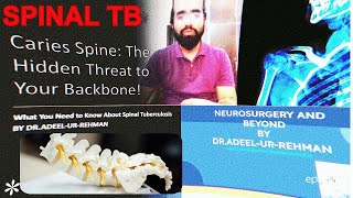 STOP Ignoring These Caries Spine Symptoms and Take Action [upl. by Frendel765]