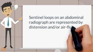 What are sentinel loops [upl. by Vaios]