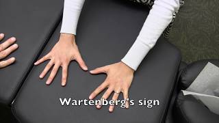 Wartenbergs Sign [upl. by Hadihsar]