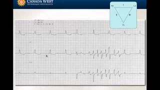 The Cardiac Workup  Physical Examination NonInvasive Blood Pressure and ECG  part 4 [upl. by Hardi]