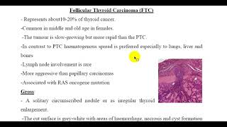 Follicular Thyroid Carcinoma FTC [upl. by Alegnat]