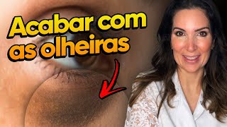 A verdade sobre como tirar as olheiras Dicas para clarear e tratar em casa comotirarolheiras [upl. by Lori]