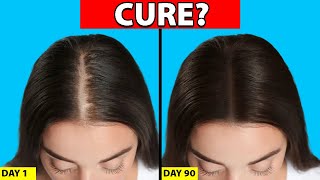 Womens Hair Loss Treatments That ACTUALLY WORK [upl. by Asial]