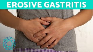 EROSIVE GASTRITIS  Belly Pain And Vomiting [upl. by Hewart]