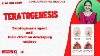 TeratogenesisTeratogenic Agent And their Effects on embryonic developmentdevelopmentalbiology [upl. by Krystal]