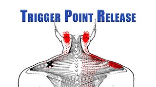 Trigger Point Release  Upper Trapezius Levator Scapulae and Suboccipitals  No Tools Needed [upl. by Enrobyalc867]