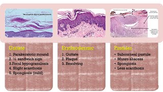 1 Psoriasiform Dermatoses  Psoriasis [upl. by Noret]