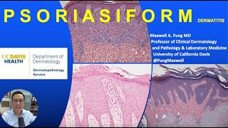 DERMATOPATHOLOGY Psoriasiform Dermatitis [upl. by Ardnuek922]