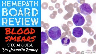 Hemepath amp Hematology Board Review Peripheral Blood Smears with Dr Jeanette Ramos [upl. by Abbey]