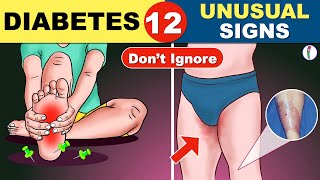 12 Unusual Symptoms of Diabetes  Diabetes Symptoms  Diabetes Mellitus   Diabetes Warning Signs [upl. by Tricia]