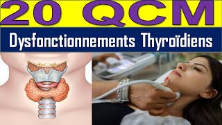 20 QCM Hyperthyroïdie ou Hypothyroïdie  Découvrez les Causes et Solutions [upl. by Ross841]