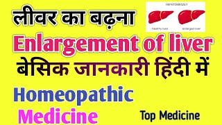 Hepatomegaly  लीवर में सूजन  Homeopathic Medicine  बेसिक जानकारी Dr AK Patel [upl. by Olzsal]