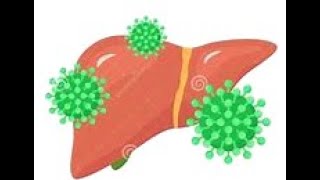 Herpes Liver Failure in PregnancyBrief Overview [upl. by Wharton]