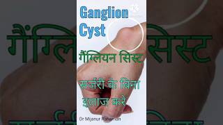 गैंग्लियन सिस्ट  Ganglion Cyst Homoeopathy Medicin fitness homeopathy [upl. by Lettig]