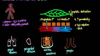 Disorders of Circulation Edema [upl. by Doss217]