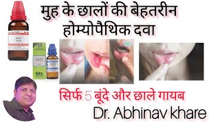 मुंह के छाले Mouth Ulcer को 1 ही जड़ से ठीक करने के रामबाण उपाय Mouth Ulcer Muh ke chhale ka ilaj [upl. by Mairam]