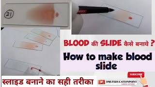 blood की slide कैसे बनाये slide kaise bnaye  HematologyMaking a paripheral Blood smear slide [upl. by Ramalahs320]