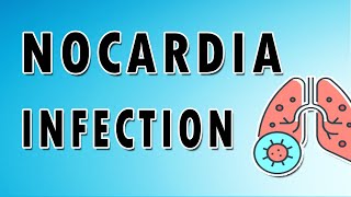 Nocardia Infection [upl. by Nickey762]