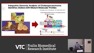 Intrahepatic Cholangiocarcinoma From Diagnosis to Treatment [upl. by Gilligan789]