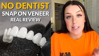 Snap On Removable Dental Veneers Review  The Best Alternative to 20000 Cosmetic Dentistry [upl. by Suoivatram]