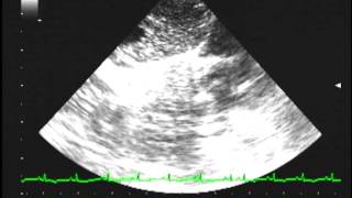 Heartworm disease echocardiography [upl. by Acinomaj]