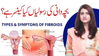 What is Fibroids in Uterus  Symptoms and Types of Fibroids  Dr Maryam Raana Gynaecologist [upl. by Zsolway]