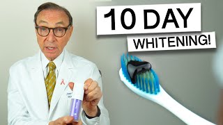 Hismile Purple Toothpaste for 10 Days  Dentist Review teethwhitening [upl. by Neeleuqcaj]