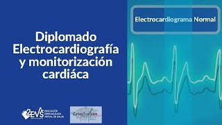 Electrocardiograma normal [upl. by Efar545]