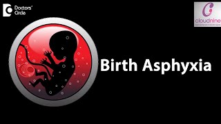 What is the meaning of Birth Asphyxia  Dr Piyush Shah of Cloudnine Hospitals  Doctors’ Circle [upl. by Carri]