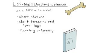 LeriWeill dyschondrosteosis [upl. by Adnirual]