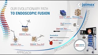 Our Evolutionary Path To Endoscopic Fusion [upl. by Hteboj]