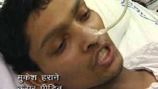 India  Mukesh Smokeless Tobacco Campaign Hindi  Testimonial [upl. by Origra77]