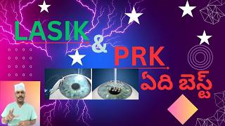 LASIK VS PRK WHAT TO CHOOSE  LASIK VS PRK ఏది బెస్ట్   TELUGU [upl. by Mcgray319]