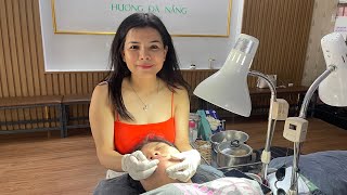 Acne treatment Hương Đà Nẵng đang phát trực tiếp live 2024 [upl. by Cirda]