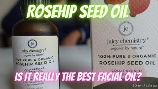 Juicy chemistry Rosehip Seed oil review  Best Facial Oil for oily skin [upl. by Lehcin]