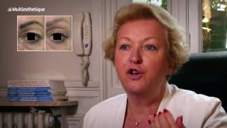 Blépharoplastie médicale  une technique non invasive pour rajeunir – Dr Catherine de Goursac [upl. by Llabmik]