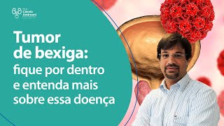 Tumor de bexiga entenda mais sobre essa doença  Dr Cássio Andreoni Ribeiro CRM 78546 [upl. by Remlap]