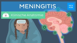 Meningitis Hirnhautentzündung Ursachen Symptome Behandlung  Kenhub [upl. by Down]