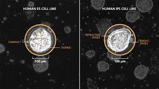 Passaging Naive PSC Colonies Derived and Maintained in RSeT™ [upl. by Crockett791]