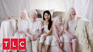 This Couple Adopted Four Children With Albinism  Born with Albinism [upl. by Ynohtnaeoj534]