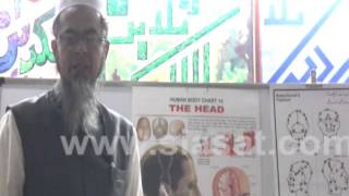 Hijama Benefits for Head part 2 [upl. by Andris664]