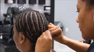 Seborrheic Dermatitis Sew in Weave Education and Hair Tips [upl. by Nedle]