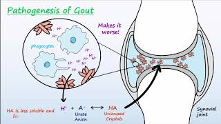 Gout  Mechanisms amp Treatment [upl. by Mallory]