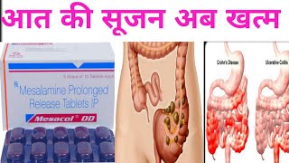 MesacalOD Mesalamine prolonged release in hindi Use Profit Sideeffects by offlineboymedico [upl. by Hagep490]