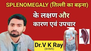 तिल्ली प्लीहा लक्षण कारण इलाज और निदान splemomegaly treatment in hindi 💯✅ [upl. by Marquet]