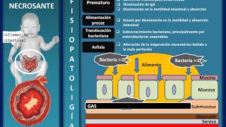 Enterocolitis necrosante neonatal fisiopatología criterios de Bell tratamiento enarm [upl. by Sigfrid]