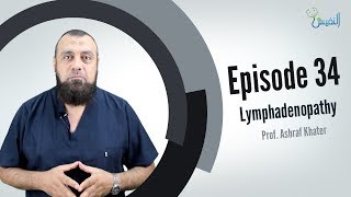 Lymphadenopathy  Surgery [upl. by Dnumsed]